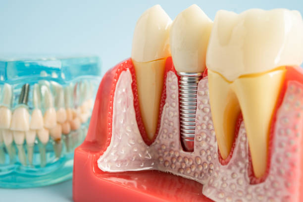 Best Cosmetic Dentistry  in Mesquite, TX